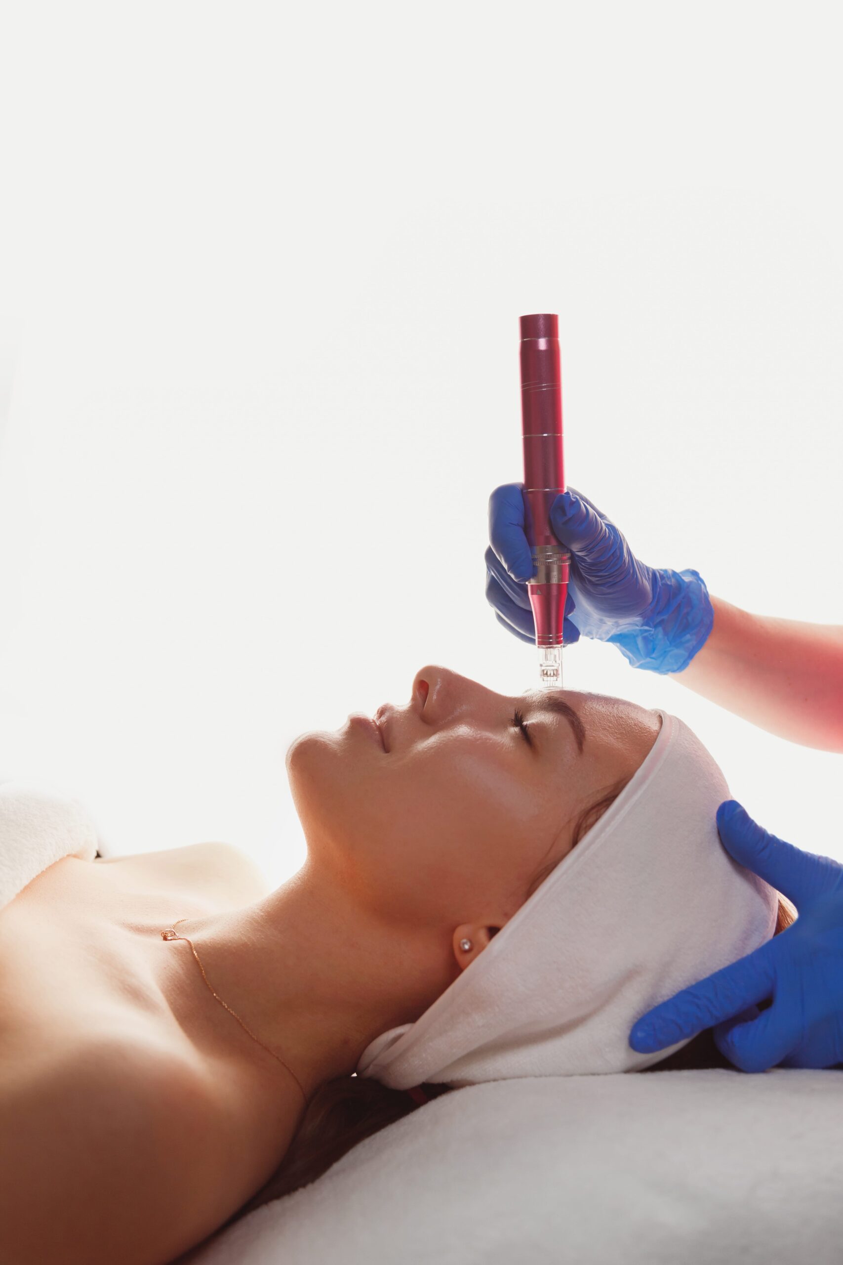 beautician-is-using-dermapen-on-woman-face-skin-s-2025-02-12-04-51-03-utc-min Beautician is using dermapen on woman face skin, side view