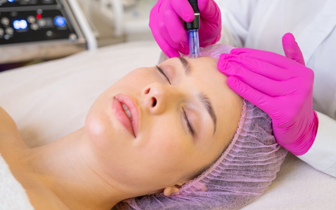 What Is PRP Microneedling and Why Is It So Effective?