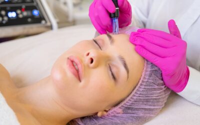 What Is PRP Microneedling and Why Is It So Effective?