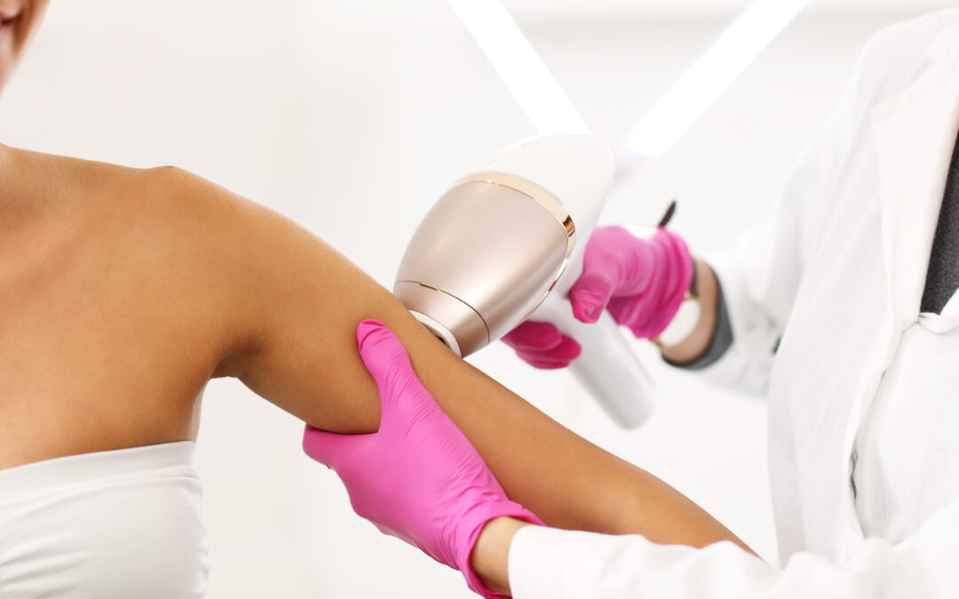 Benefits of Laser Hair Removal