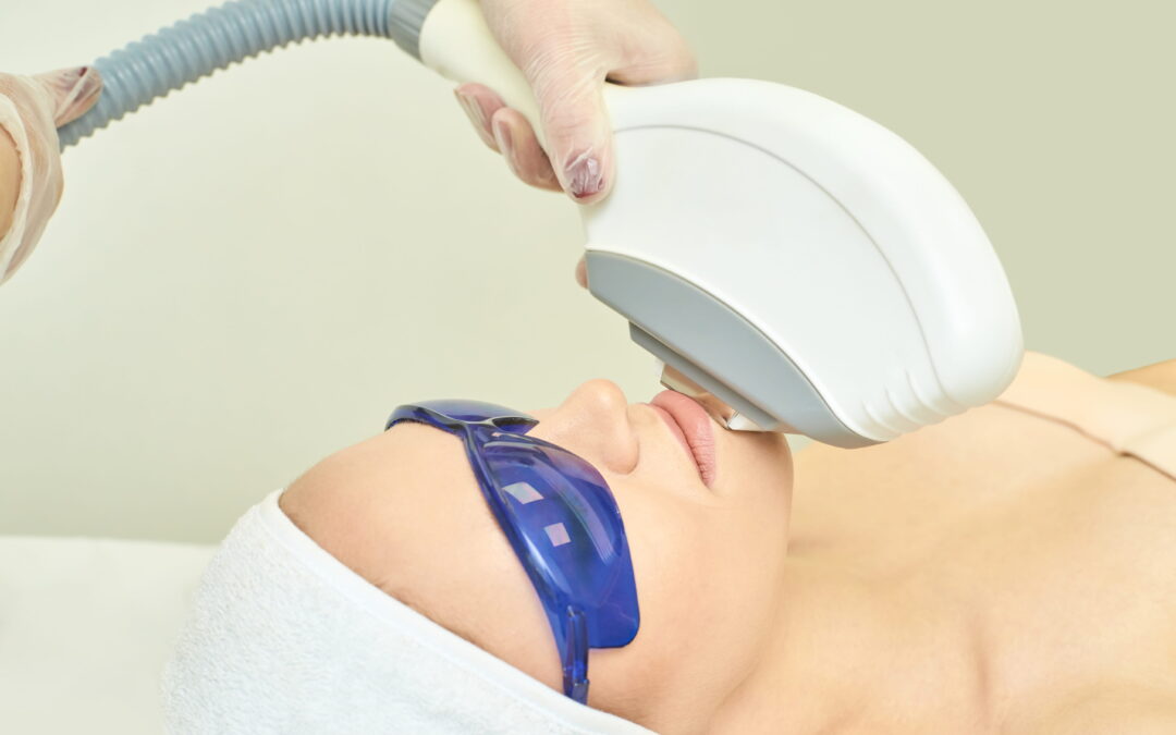 IPL vs. Laser Hair Removal
