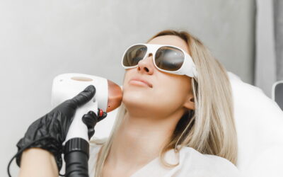 Benefits of BBL Laser