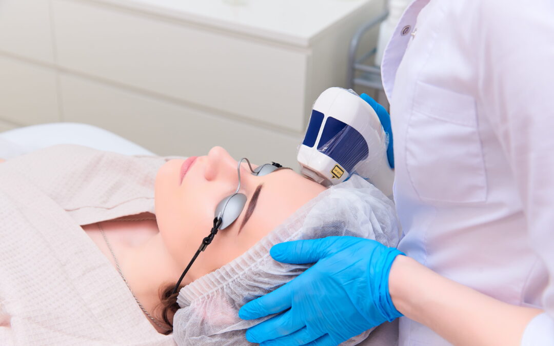 Forever Young BBL for Sun Damage & Brown Spots