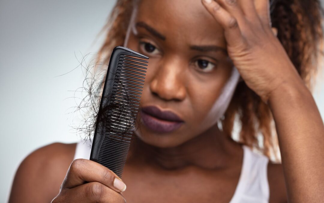 PRF for Hair Loss